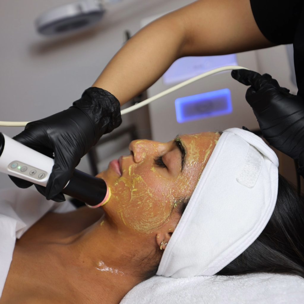 Oxygeno facial